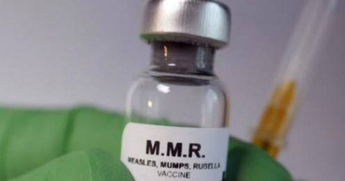 “Alert: Mumps Exposure on International Flights to New Zealand”